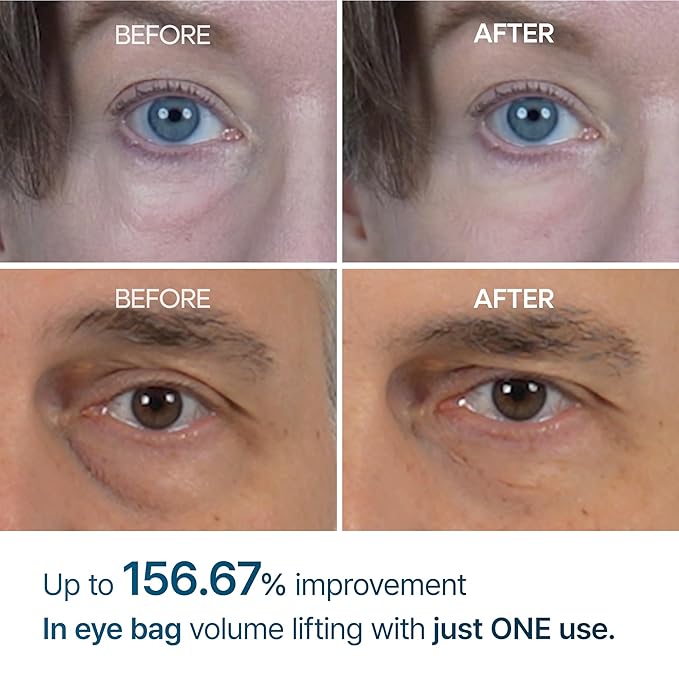 Dr. Melaxin Eyephalt for Dark Circles and Puffiness